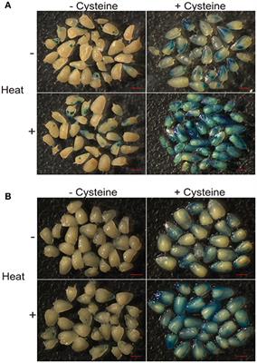 Transcriptome Analysis of Maize Immature Embryos Reveals the Roles of Cysteine in Improving Agrobacterium Infection Efficiency